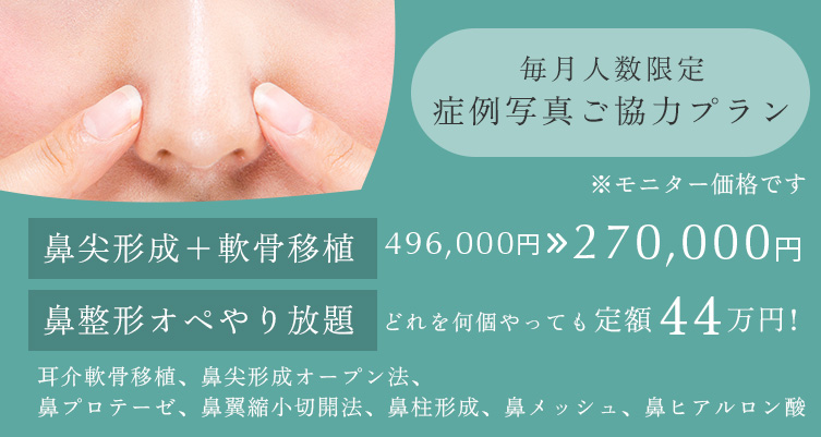 毎月人数限定 症例写真ご協力プラン 鼻尖形成+軟骨移植 496,000円→270,000円、鼻整形オペやり放題 どれを何個やっても44万円