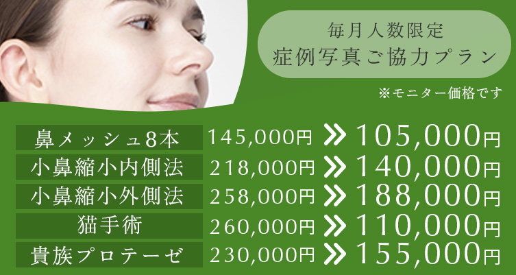 毎月人数限定 症例写真ご協力プラン 鼻メッシュ8本 145,000円→105,000円、小鼻縮小内側法 218,000円→140,000円、小鼻縮小外側法 378,000円→188,000円、猫手術 260,000円→110,000円、貴族プロテーゼ 230,000円→155,000円