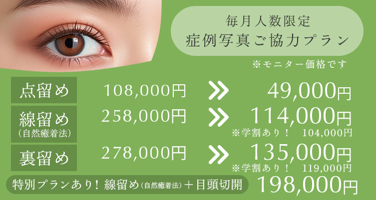 毎月人数限定 症例写真ご協力プラン 点留め　108,000円→49,000円、線留め 258,000円→114,000円（学割あり：104,000円）、　裏留め 278,000円→135,000円（学割あり：119,000円）、特別プランあり！線留め（自然癒着法）＋目頭切開 198,000円