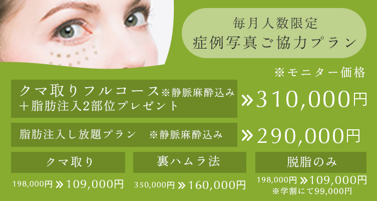 毎月人数限定 症例写真ご協力プラン クマ取りフルコース※静脈麻酔込み＋脂肪注入2部位プレゼント 310,000円、脂肪注入し放題プラン※静脈麻酔込み 290,000円、クマ取り 198,000円→109,000円、裏ハラム法 350,000円→160,000円、脱脂のみ 198,000円→109,000円（学割にて99,000円）