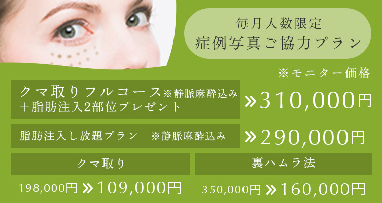 毎月人数限定 症例写真ご協力プラン クマ取りフルコース※静脈麻酔込み＋脂肪注入2部位プレゼント 310,000円、脂肪注入し放題プラン※静脈麻酔込み 290,000円、クマ取り 198,000円→109,000円、裏ハムラ法 350,000円→160,000円