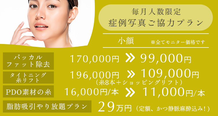 毎月人数限定 症例写真ご協力プラン 小顔 バッカルファット除去 170,000円→99,000円、タイトニング糸リフト 196,000円→1090,000円（糸8本＋ショッピングリフト）、PDO素材の糸 16,000円/本→11,000円/本、脂肪吸引やり放題プラン 29万円（定額、かつ静脈麻酔込み）