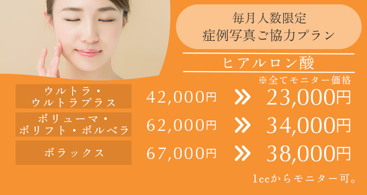 毎月人数限定 症例写真ご協力プラン ヒアルロン酸 ウルトラ・ウルトラプラス 42,000円→23,000円、ボリューム・ボリフト・ボルベラ 62,000円→34,000円、ボラックス 67,000円→38,000円