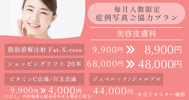 毎月人数限定 症例写真ご協力プラン 美容皮膚科 脂肪溶解注射　Fat-X-core 9,900円→8,900円、ショッピングリフト20本 68,000円→48,000円、ビタミンC点滴/白玉注射 9,900円→4,000円（ただし外科手術と組み合わせる場合に限る）、ジュベルック/ジャルプロ 44,000円