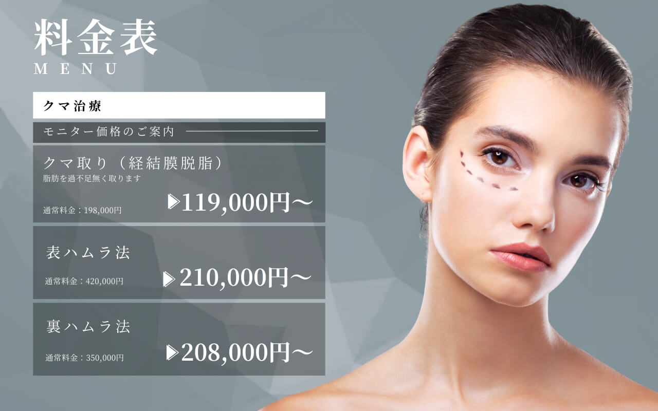 クマ取りの料金表